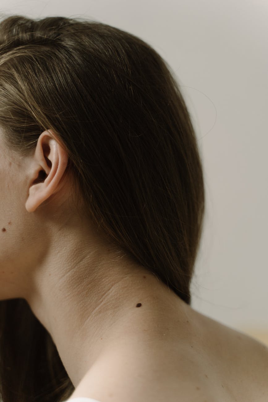 woman neck with mole